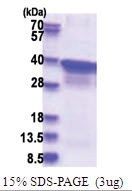 POLR2C (1-275, His-tag) Human Protein