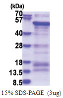 SAMSN1 (1-373, His-tag) Human Protein
