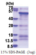 SAMSN1 (1-373, His-tag) Human Protein