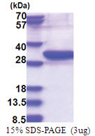 UBE2Z (1-246, His-tag) Human Protein