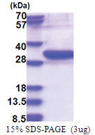 UBE2Z (1-246, His-tag) Human Protein