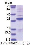 SSX2 (1-188, His-tag) Human Protein