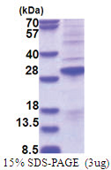 SSX2 (1-188, His-tag) Human Protein