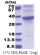 ASPHD1 (96-390, His-tag) Human Protein