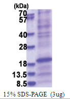 SFTPD (224-375, His-tag) Human Protein