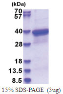 HLA class I alpha F / HLA-F (22-305, His-tag) Human Protein