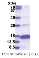 Neurogranin (1-78, His-tag) Human Protein