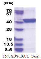 LANCL1 (1-399, His-tag) Human Protein