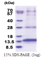 OXLD1 (46-147, His-tag) Human Protein