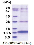 OXLD1 (46-147, His-tag) Human Protein