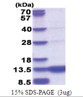 GCHFR / GFRP (1-84, His-tag) Human Protein