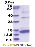 HCV NS5A (2210-2306, His-tag) Human Protein