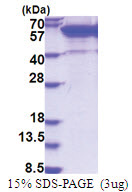 ETS2 (1-469, His-tag) Human Protein