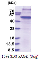 THAP11 (1-314, His-tag) Human Protein