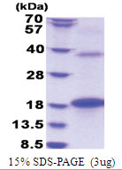 BMP8B (264-402, His-tag) Human Protein