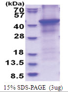 Proteoglycan link protein / HAPLN1 (16-354, His-tag) Human Protein