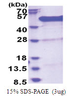 BCCIP / TOK1 (1-314, His-tag) Human Protein