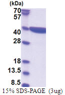 Zeta-crystallin (1-329, His-tag) Human Protein