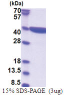 Zeta-crystallin (1-329, His-tag) Human Protein