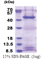 FBXO2 (1-296, His-tag) Human Protein