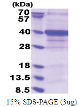 ETS2 (298-400, His-tag) Human Protein