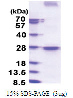 CD273 / PDL2 (20-200, His-tag) Human Protein