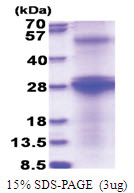HCV Envelope glycoprotein E2 (482-671, His-tag) Human Protein