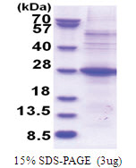 POMZP3 (1-187, His-tag) Human Protein