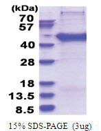 SERTAD2 (1-314, His-tag) Human Protein