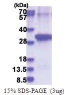 Anthrax toxin receptor 2 / ANTXR2 (34-317, His-tag) Human Protein