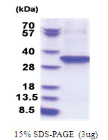 EEF2 (574-858, His-tag) Human Protein