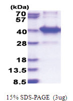 AMMECR1L (1-310, His-tag) Human Protein