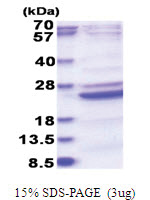 B9D2 (1-175, His-tag) Human Protein