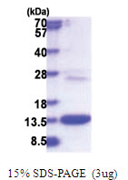COMMD6 (1-85, His-tag) Human Protein