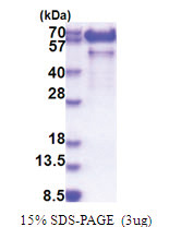 PALM (1-387, His-tag) Human Protein