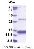 4E-BP3 (1-100, His-tag) Human Protein