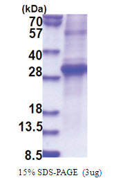 KLK11 / Kallikrein-11 (54-278) Human Protein