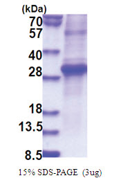 KLK11 / Kallikrein-11 (54-278) Human Protein