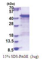 DUSP6 (1-381, His-tag) Human Protein