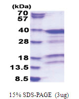 PRKRA / PACT (1-313, His-tag) Human Protein