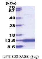 CAMK2N2 (1-79, His-tag) Human Protein