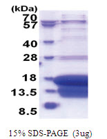 Death-associated protein 1 (1-102, His-tag) Human Protein