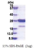 STXBP6 / Amysin (1-210, His-tag) Human Protein