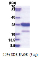 STXBP6 / Amysin (1-210, His-tag) Human Protein