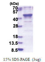 MERIT40 (1-329, His-tag) Human Protein