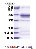 RPL5 (1-297, His-tag) Human Protein
