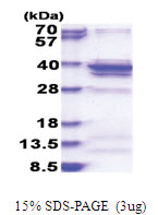 RPL5 (1-297, His-tag) Human Protein