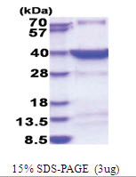 HSF2BP (1-334, His-tag) Human Protein