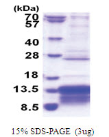 MUSTN1 (1-82, His-tag) Human Protein