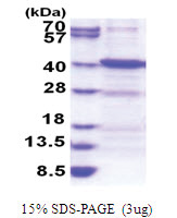 ANKRA2 (1-313, His-tag) Human Protein
